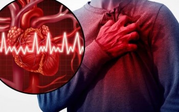 10 Sinais e Sintomas que Podem Preceder um Infarto